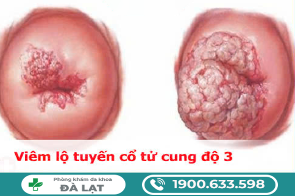 Hình ảnh minh họa